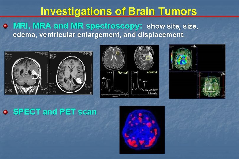 Investigations of Brain Tumors MRI, MRA and MR spectroscopy: show site, size, edema, ventricular