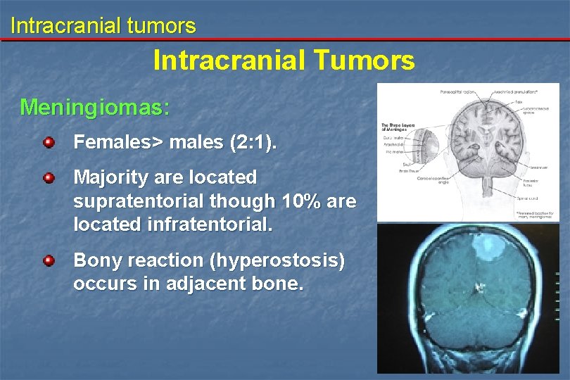 Intracranial tumors Intracranial Tumors Meningiomas: Females> males (2: 1). Majority are located supratentorial though