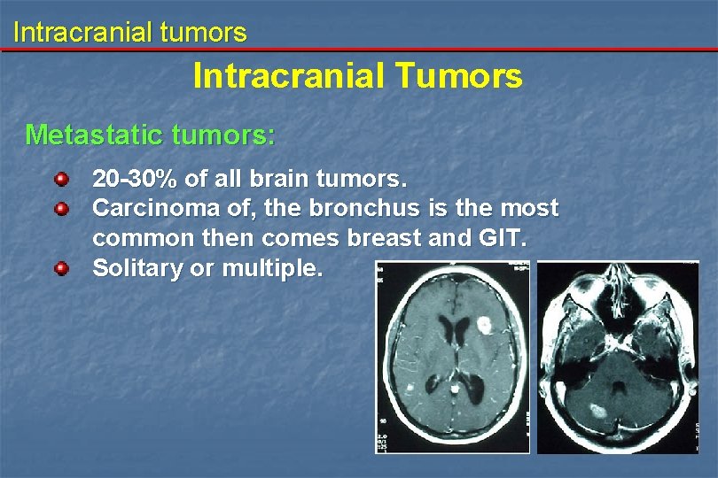 Intracranial tumors Intracranial Tumors Metastatic tumors: 20 -30% of all brain tumors. Carcinoma of,