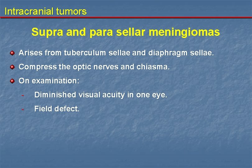 Intracranial tumors Supra and para sellar meningiomas Arises from tuberculum sellae and diaphragm sellae.