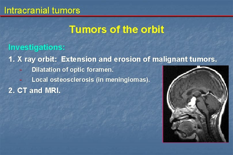 Intracranial tumors Tumors of the orbit Investigations: 1. X ray orbit: Extension and erosion