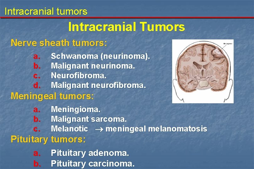 Intracranial tumors Intracranial Tumors Nerve sheath tumors: a. b. c. d. Schwanoma (neurinoma). Malignant