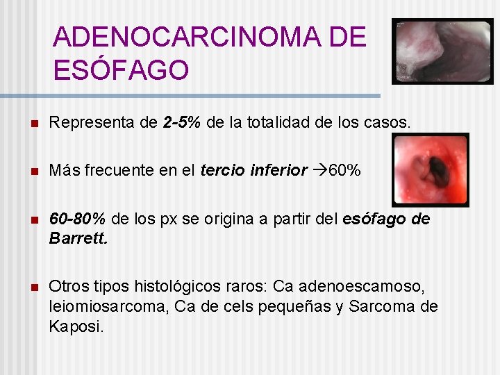 ADENOCARCINOMA DE ESÓFAGO n Representa de 2 -5% de la totalidad de los casos.