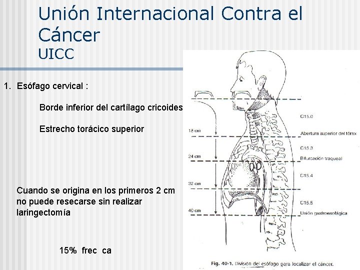 Unión Internacional Contra el Cáncer UICC 1. Esófago cervical : Borde inferior del cartílago