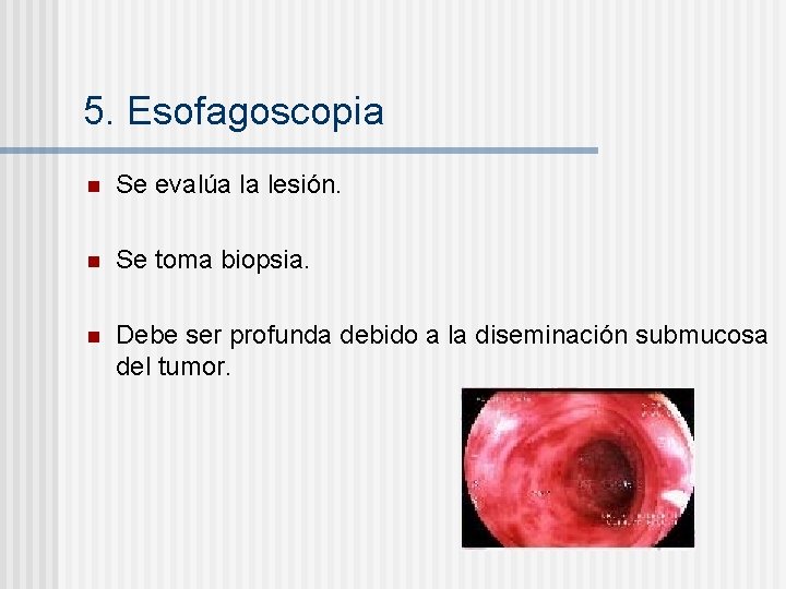 5. Esofagoscopia n Se evalúa la lesión. n Se toma biopsia. n Debe ser