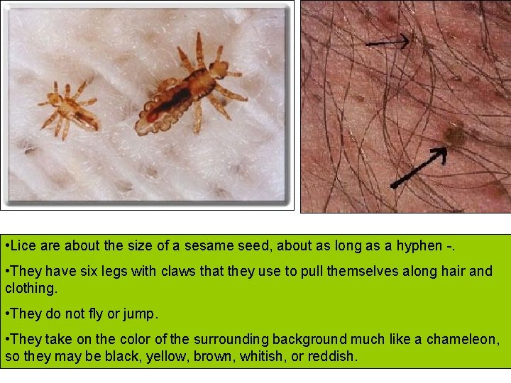  • Lice are about the size of a sesame seed, about as long