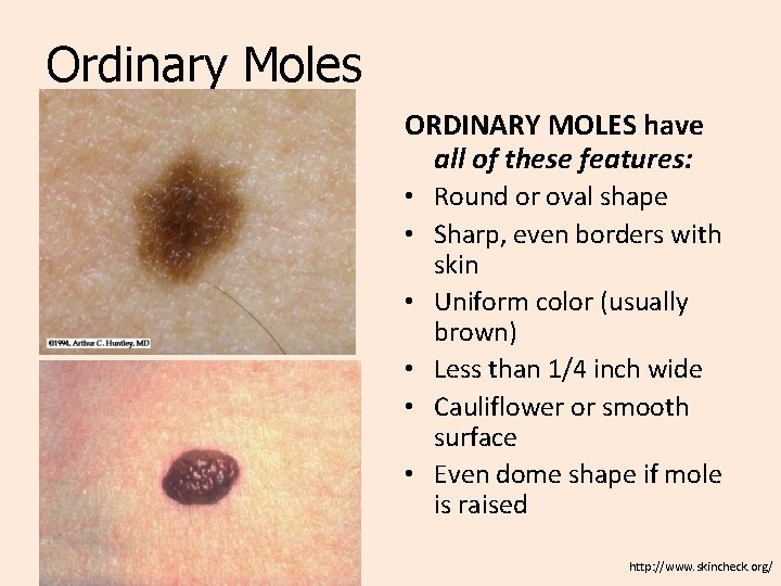Ordinary Moles ORDINARY MOLES have all of these features: • Round or oval shape