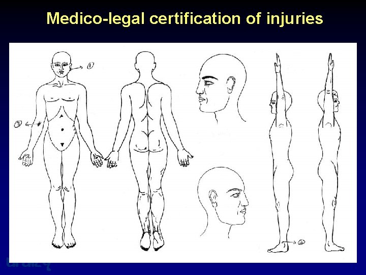 Medico-legal certification of injuries uraizy 