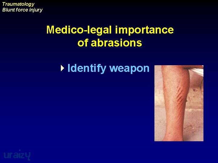 Traumatology Blunt force injury Medico-legal importance of abrasions 4 Identify weapon uraizy 