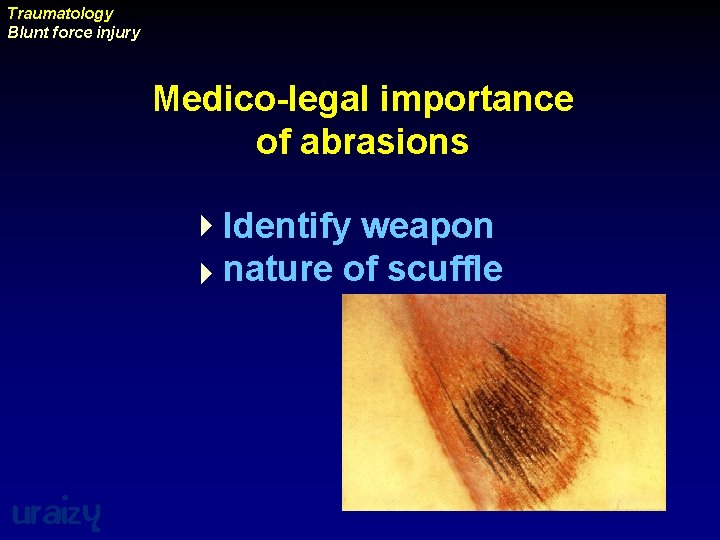 Traumatology Blunt force injury Medico-legal importance of abrasions 4 Identify weapon 4 nature of