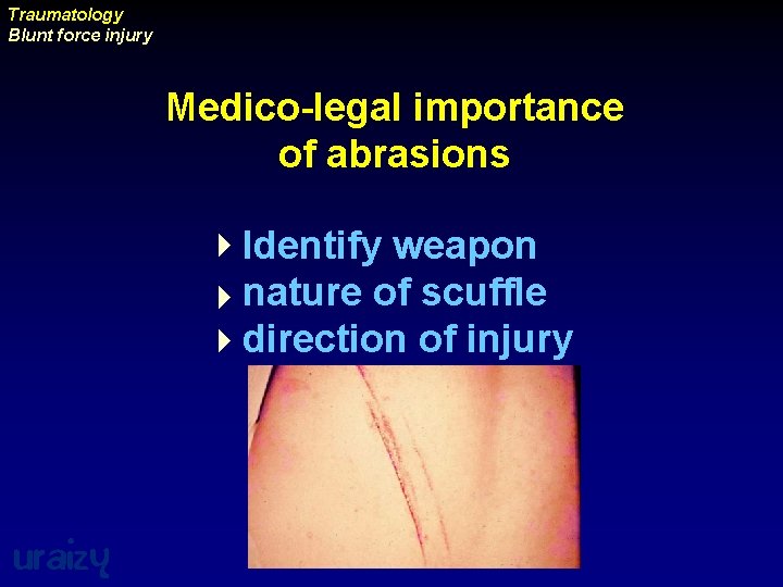 Traumatology Blunt force injury Medico-legal importance of abrasions 4 Identify weapon 4 nature of