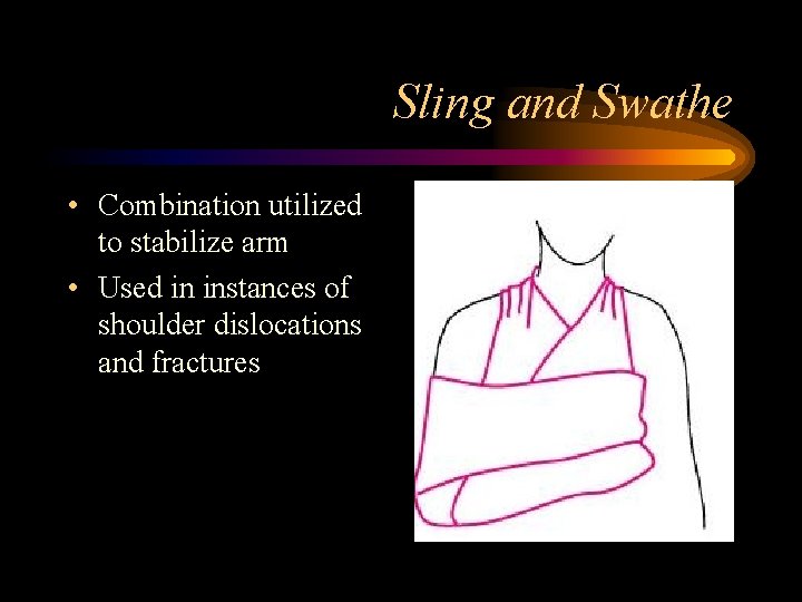 Sling and Swathe • Combination utilized to stabilize arm • Used in instances of