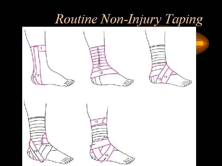 Routine Non-Injury Taping 