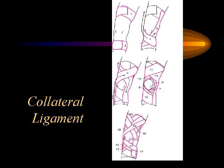 Collateral Ligament 