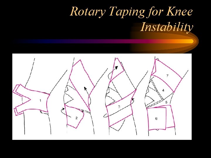 Rotary Taping for Knee Instability 