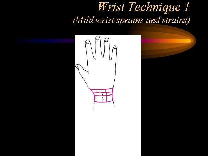 Wrist Technique 1 (Mild wrist sprains and strains) 