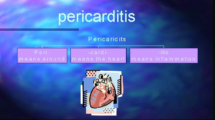 pericarditis 