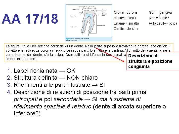 AA 17/18 Crown= corona Gum= gengiva Neck= colletto Root= radice Enamel= smalto Pulp cavity=