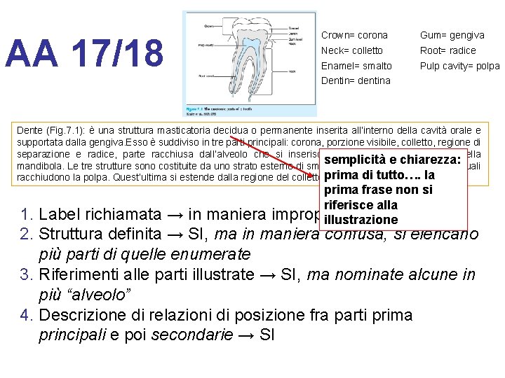 AA 17/18 Crown= corona Gum= gengiva Neck= colletto Root= radice Enamel= smalto Pulp cavity=