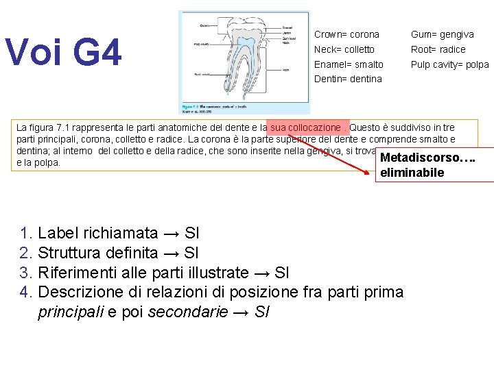 Voi G 4 Crown= corona Gum= gengiva Neck= colletto Root= radice Enamel= smalto Pulp