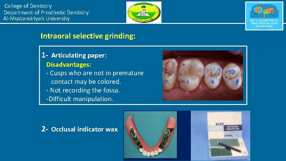 College of Dentistry Department of Prosthetic Dentistry Al-Mustansiriyah University Intraoral selective grinding: 1 -