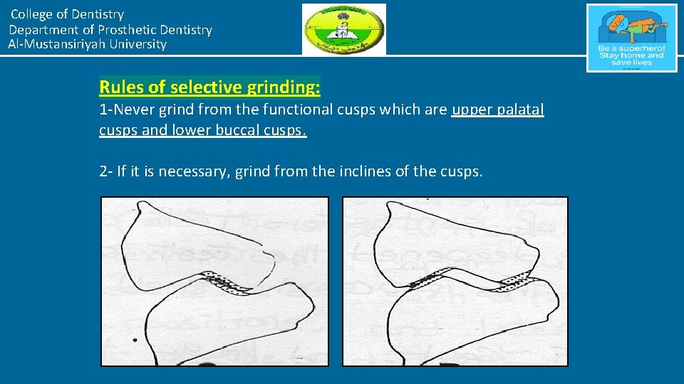 College of Dentistry Department of Prosthetic Dentistry Al-Mustansiriyah University Rules of selective grinding: 1