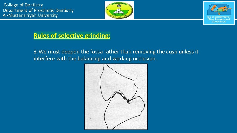 College of Dentistry Department of Prosthetic Dentistry Al-Mustansiriyah University Rules of selective grinding: 3
