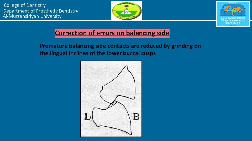 College of Dentistry Department of Prosthetic Dentistry Al-Mustansiriyah University Correction of errors on balancing