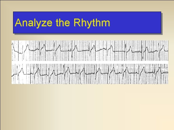 Analyze the Rhythm Analyze the Rhythm
