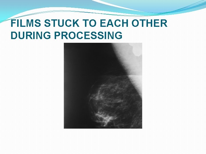 FILMS STUCK TO EACH OTHER DURING PROCESSING FILMS STUCK TO EACH OTHER DURING PROCESSING