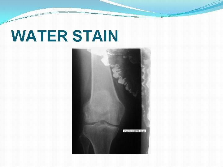 WATER STAIN WATER STAIN