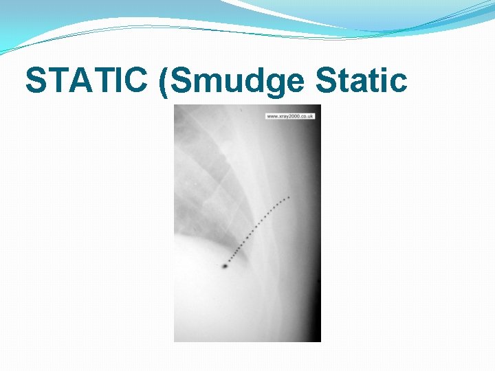 STATIC (Smudge Static 