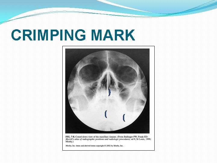 CRIMPING MARK CRIMPING MARK