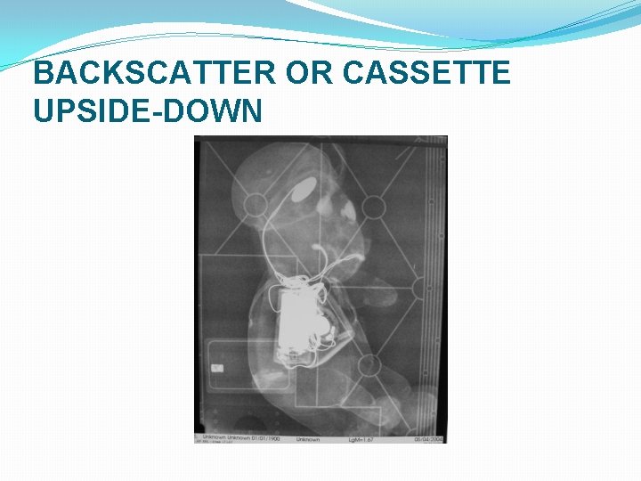 BACKSCATTER OR CASSETTE UPSIDE-DOWN BACKSCATTER OR CASSETTE UPSIDE-DOWN
