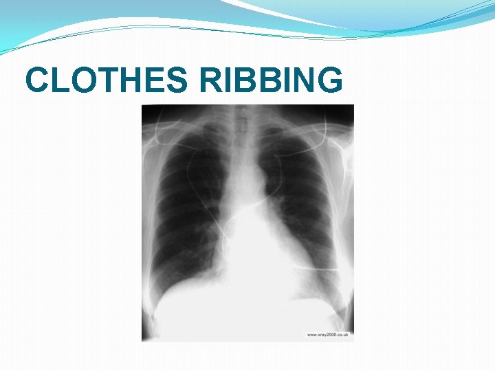 CLOTHES RIBBING CLOTHES RIBBING