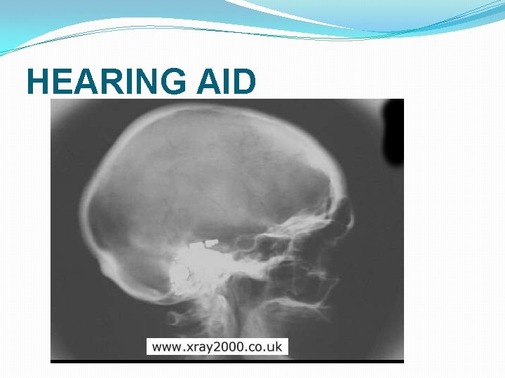HEARING AID HEARING AID