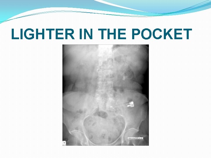 LIGHTER IN THE POCKET LIGHTER IN THE POCKET