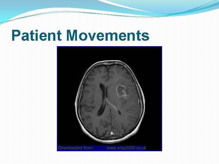 Patient Movements 