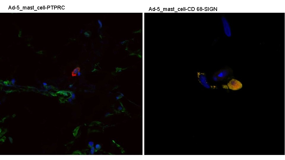 Ad-5_mast_cell-PTPRC Ad-5_mast_cell-CD 68 -SIGN 