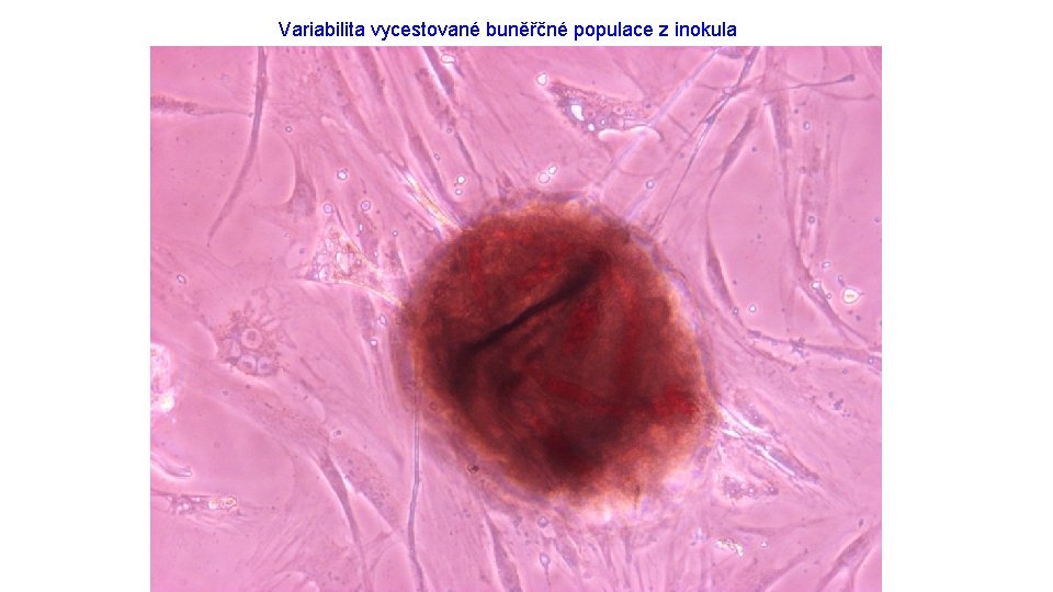 Variabilita vycestované buněřčné populace z inokula 