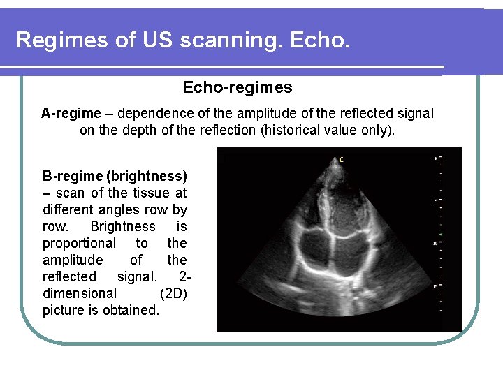 Regimes of US scanning. Echo-regimes A-regime – dependence of the amplitude of the reflected