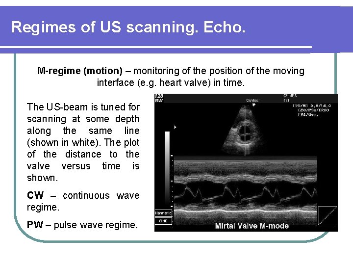 Regimes of US scanning. Echo. M-regime (motion) – monitoring of the position of the