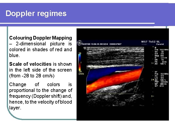 Doppler regimes Colouring Doppler Mapping – 2 -dimensional picture is colored in shades of