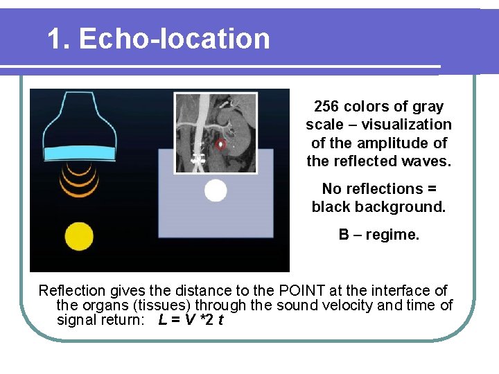 1. Echo-location 256 colors of gray scale – visualization of the amplitude of the