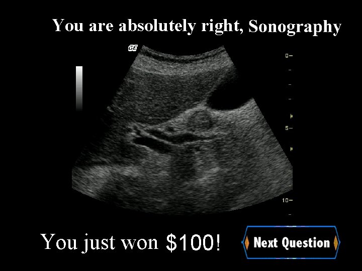 You are absolutely right, You just won $100! 