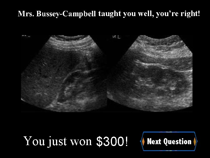 taught you well, you’re right! You just won $300! 