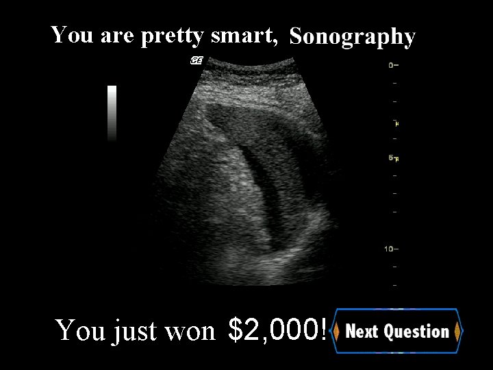 You are pretty smart, You just won $2, 000! 