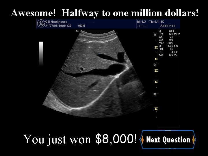 Awesome! Halfway to one million dollars! You just won $8, 000! 