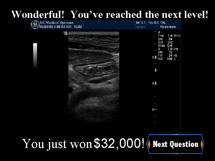 Wonderful! You’ve reached the next level! You just won $32, 000! 
