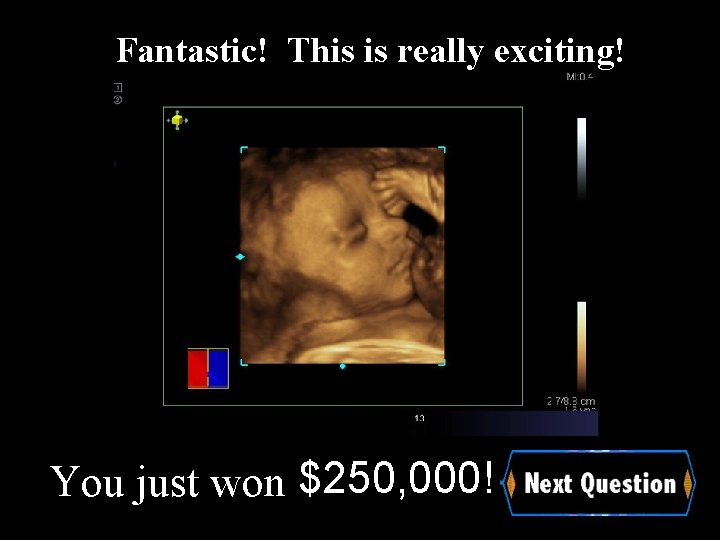 Fantastic! This is really exciting! You just won $250, 000! 